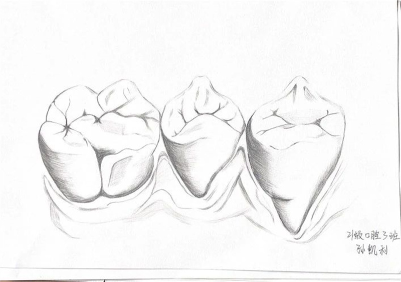 【医学技术系】我院医学技术系举办口腔牙体形态素描大赛